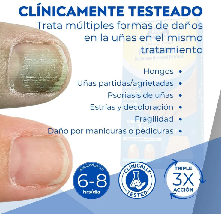 Parches Antihongo FungalNail Pro™ Elimina el Hongo en las uñas Facilmente