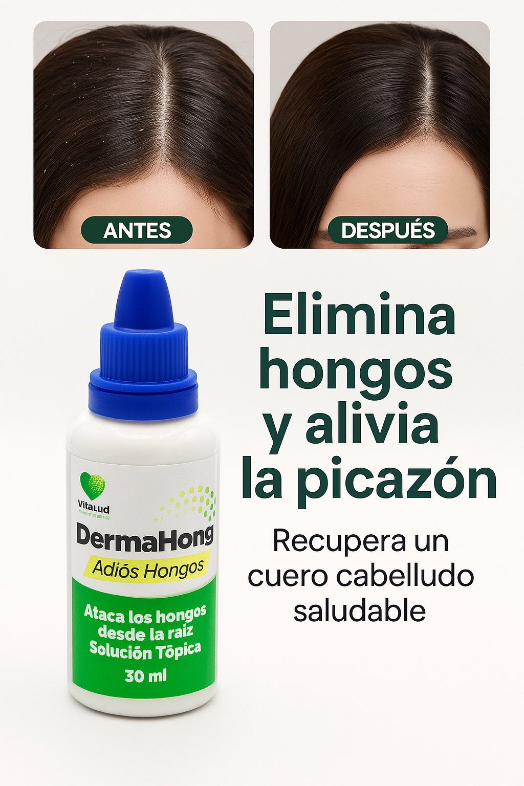 Dermahong™ Gotas Fungicidas Anti- Hongos ( Oferta Dieciochera 3x1)