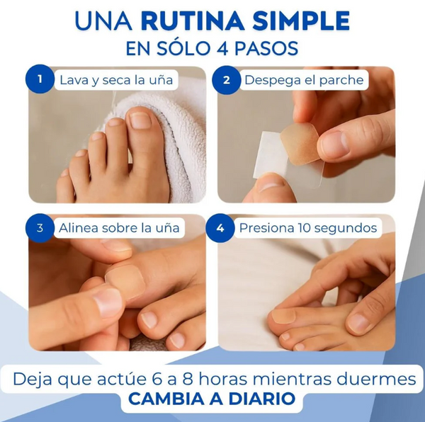 Parches Antihongo FungalNail Pro™  Elimina el Hongo en las uñas Facilmente