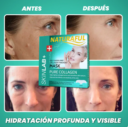 Naturaful™  Parches de Colageno Pack de 6